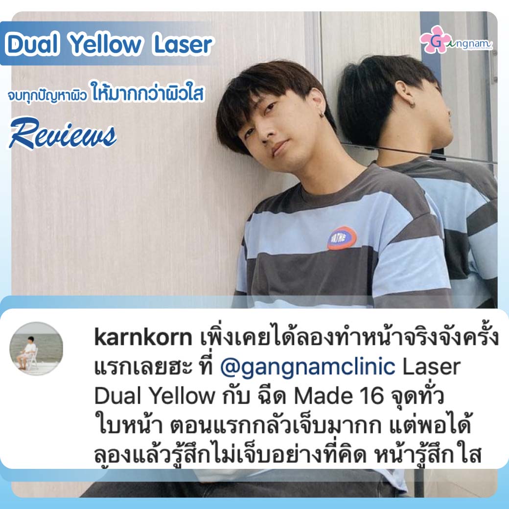 IDOL-DUAL-YELLOW15