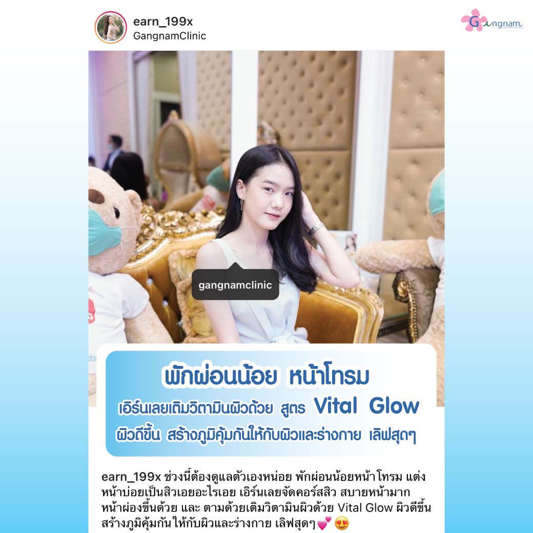 รวม-IDol-ฉีดผิว-13