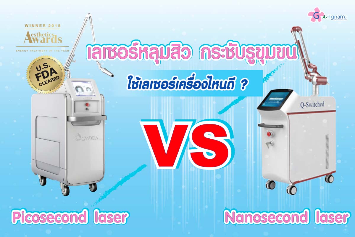 เครื่องเลเซอร์รักษาหลุมสิว