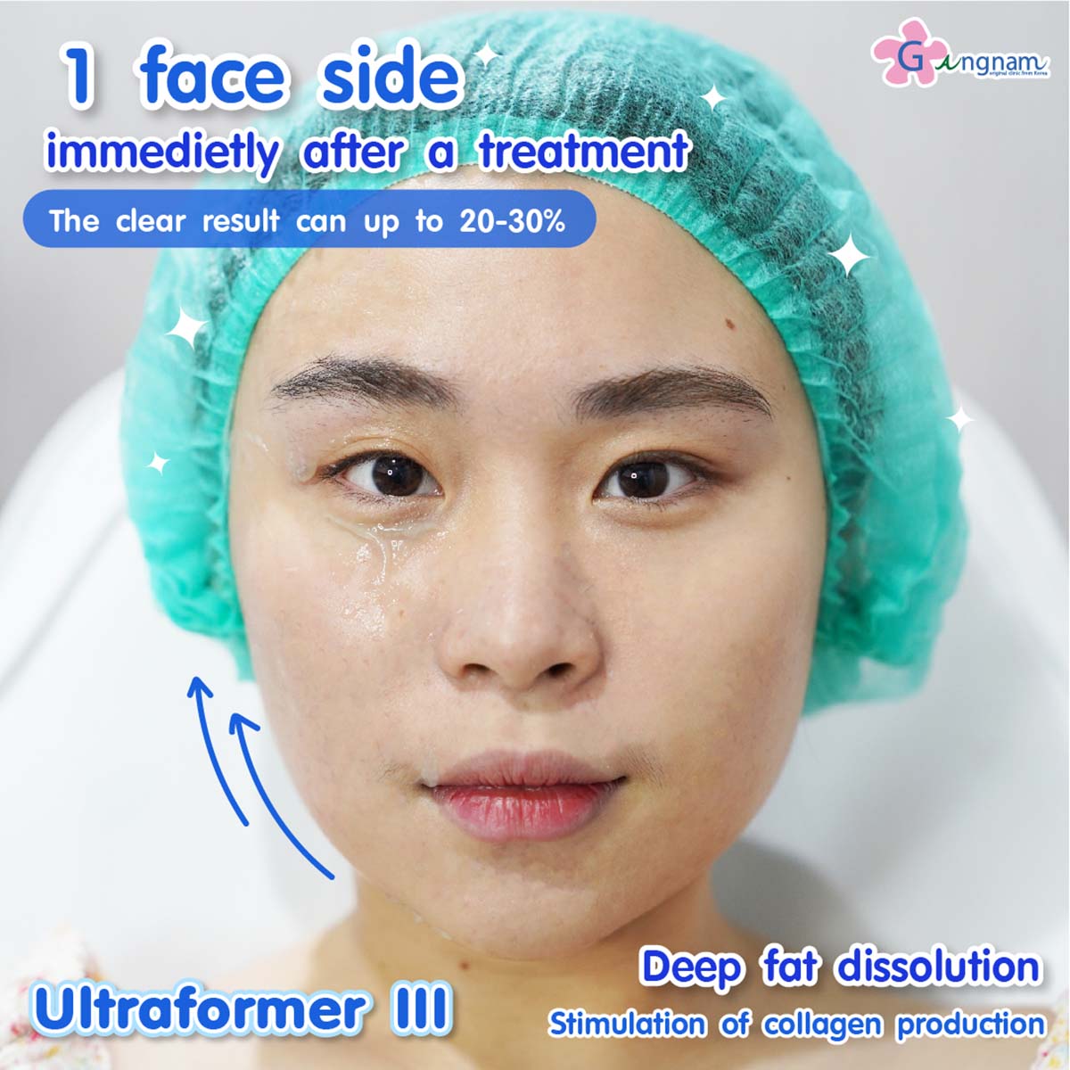 benefit Ultraformer III