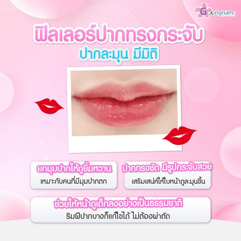 ฟิลเลอร์ปากทรงกระจับ