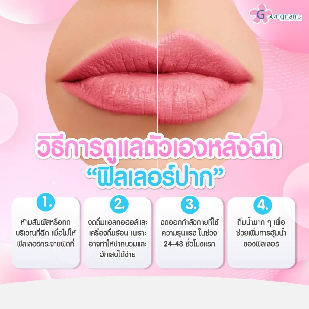 วิธีดูแลตัวเองหลังฉีด