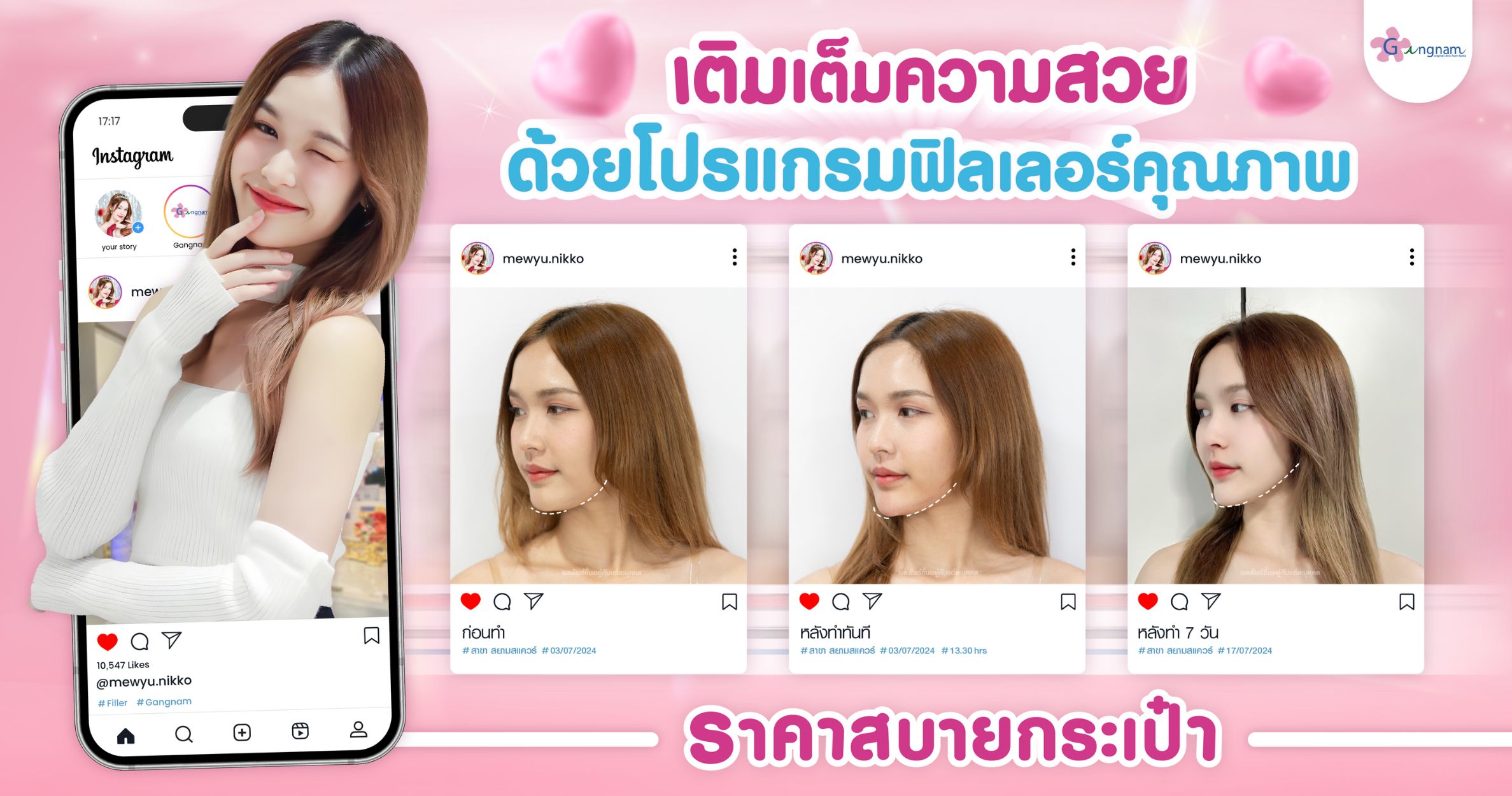 ผู้หญิงวัย25 ที่เลือกเติมความสวยที่กังนัมคลินิก