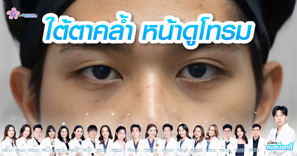 ภาพผู้ชายใต้ตาคล้ำ หน้าดูโทรม