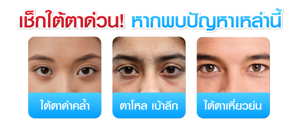 รวมปัญหาใต้ตา