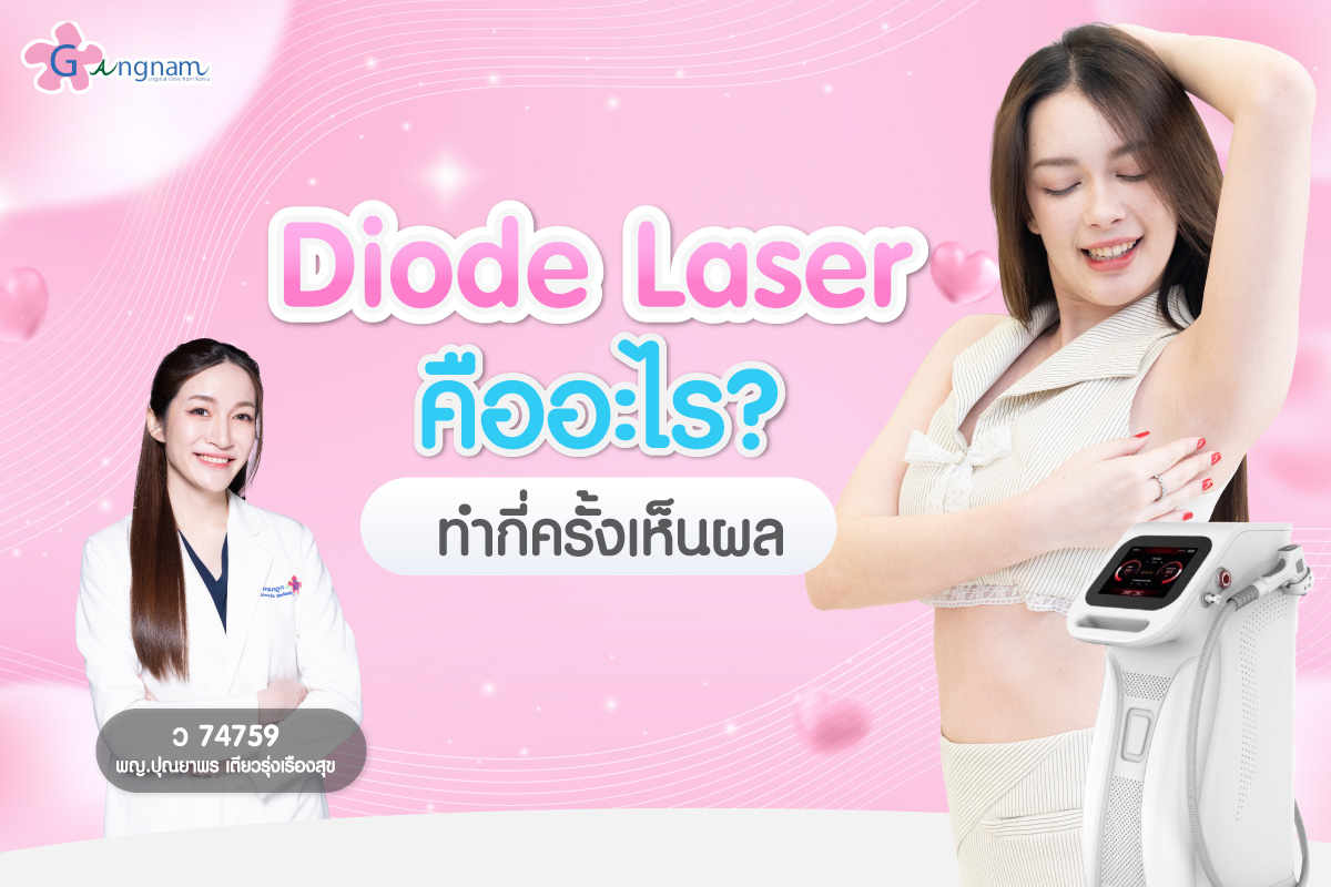 Diode Laser คืออะไร วิธีทำงาน ข้อดี ข้อเสีย และเหมาะกับใครที่สุด