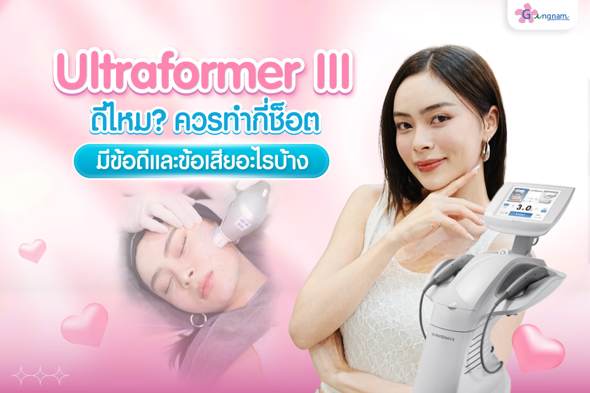 Ultraformer III ดีไหม ควรทำกี่ช็อต กี่วันเห็นผล มีข้อดีและข้อเสียอะไรบ้าง