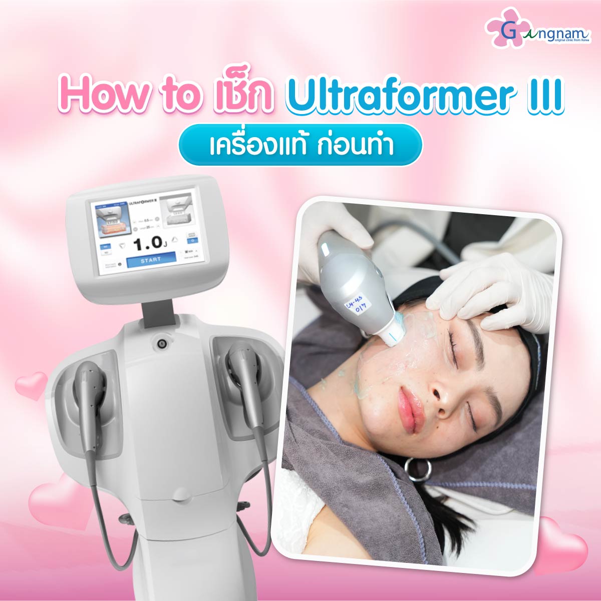 การเช็กเครื่องultraformer iiiของแท้ของปลอม