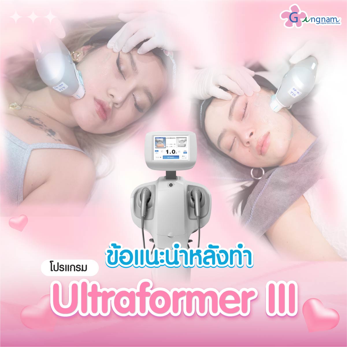 ข้อแนะนำหลังทำ ultraformer iii