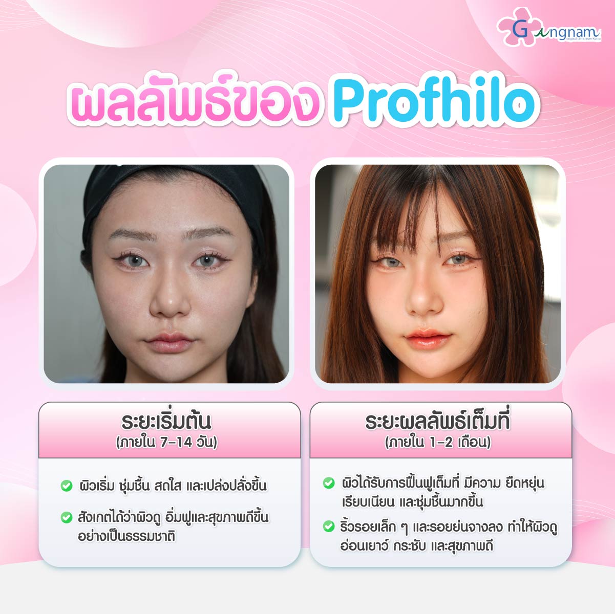 ผลลัพธ์Profhilo