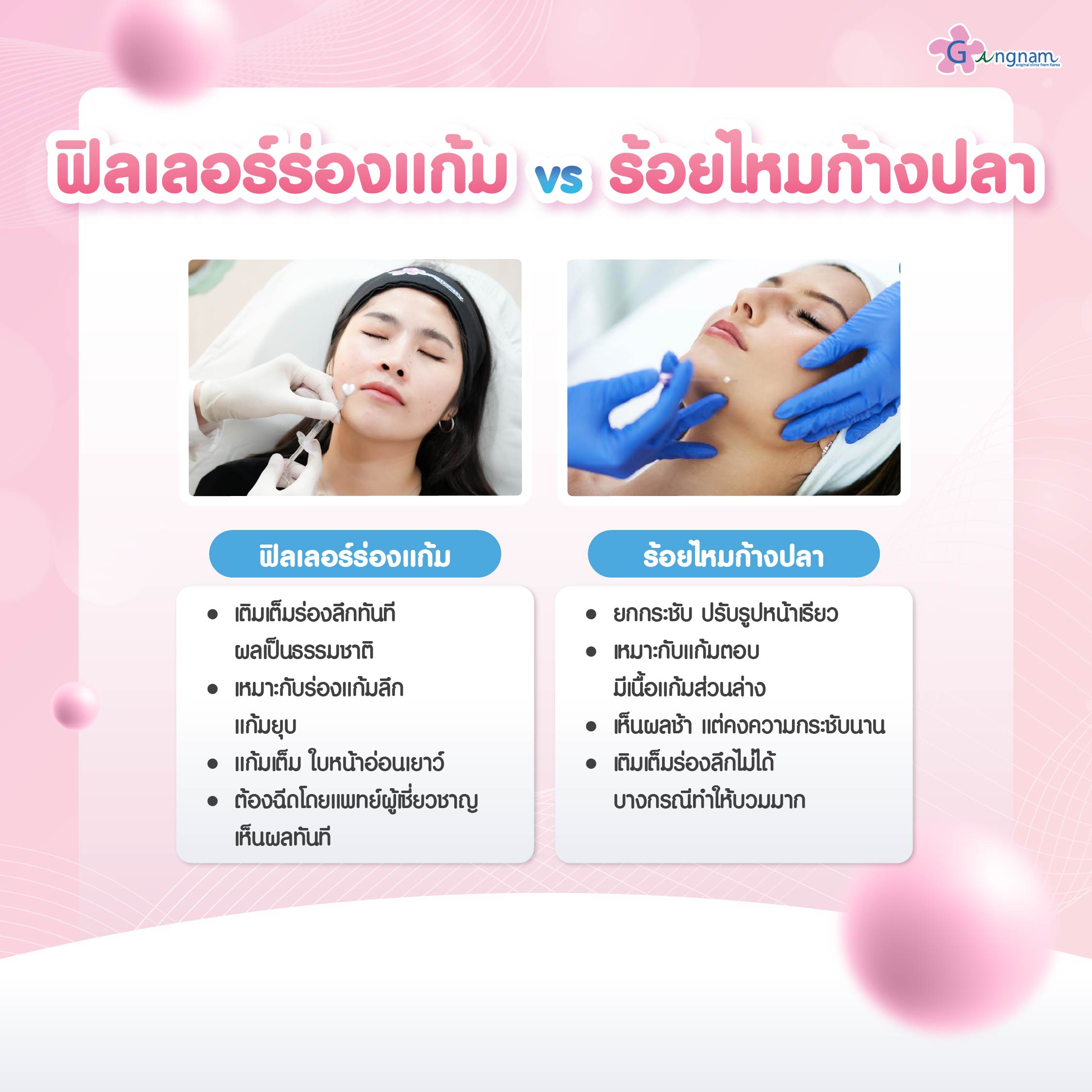 ภาพสรุปความแตกต่างฟิลเลอร์ร่องแก้มกับร้อยไหมก้างปลา