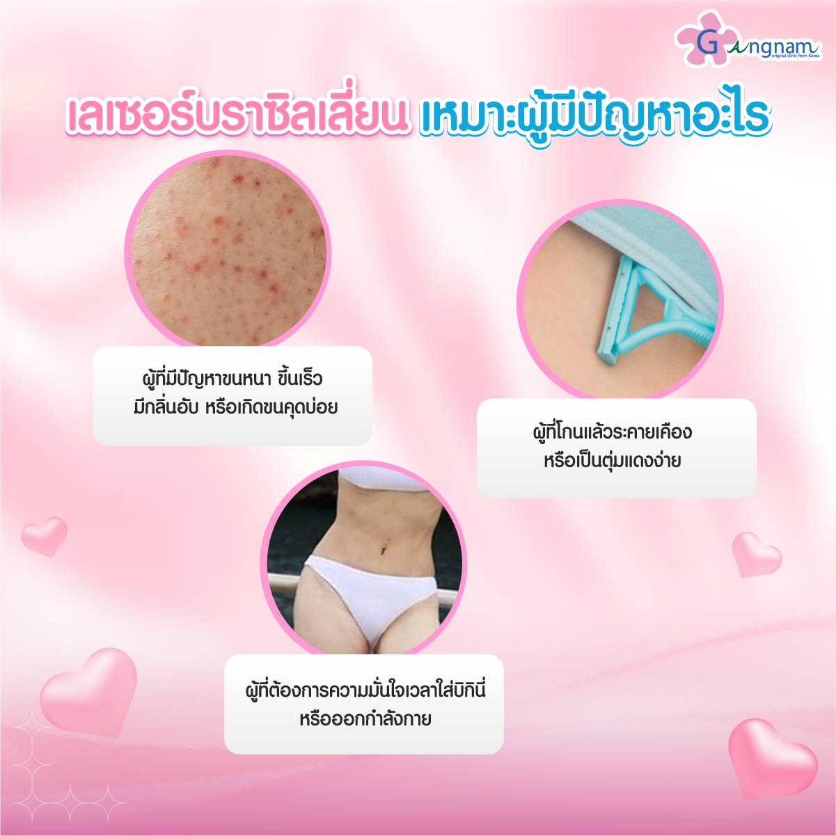 ผู้ที่เหมาะกับการทำเลเซอร์บราซิลเลี่ยน