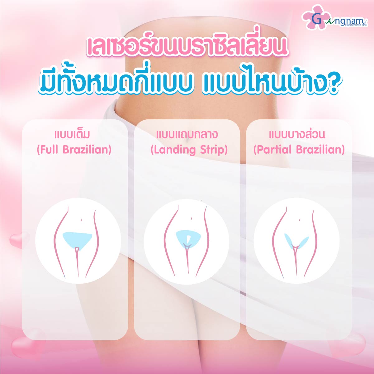 เลเซอร์บราซิลเลี่ยน มีกี่แบบ