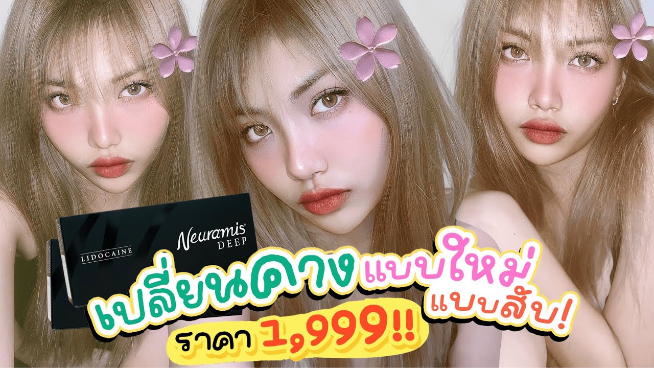 filler-คาง-gangnam