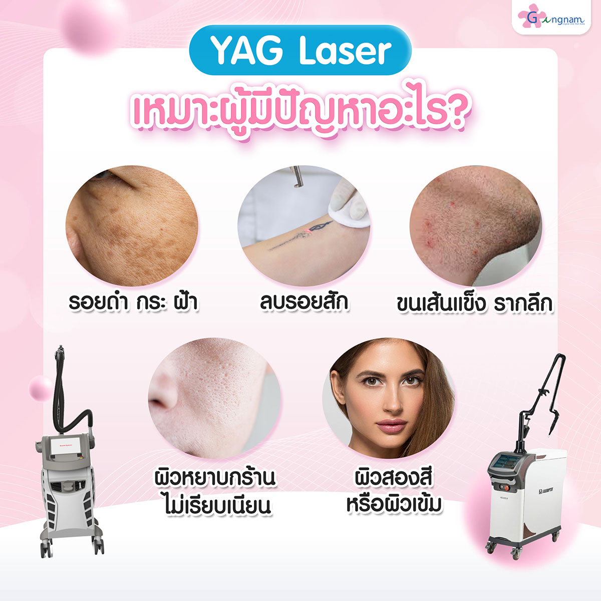 yaglaser เหมาะผู้มีปัญหาอะไรบ้าง