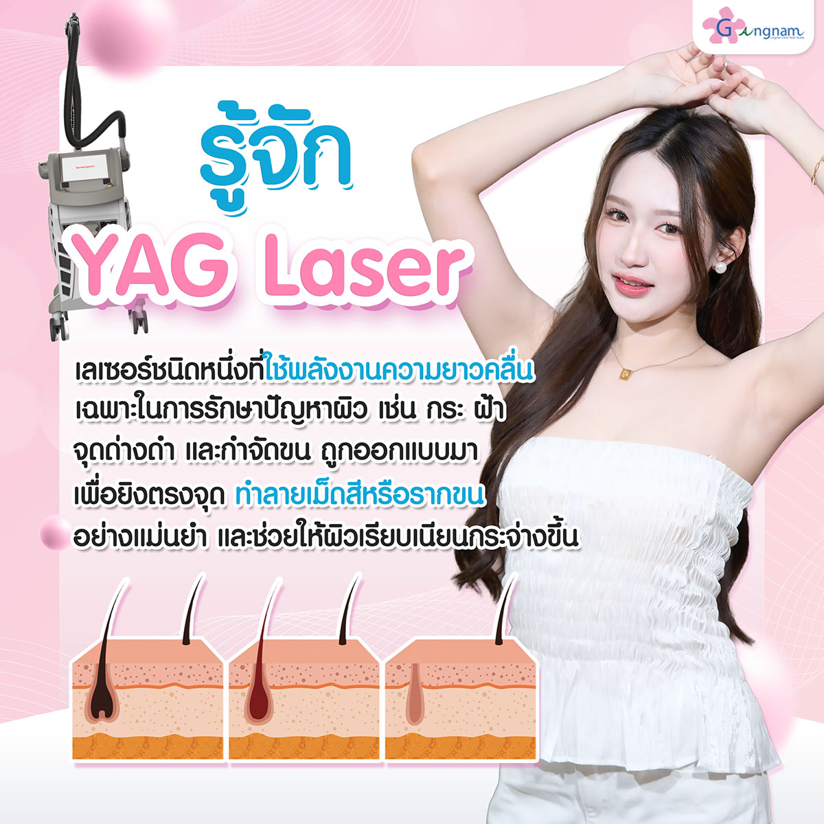 ความหมาย YAG Laser