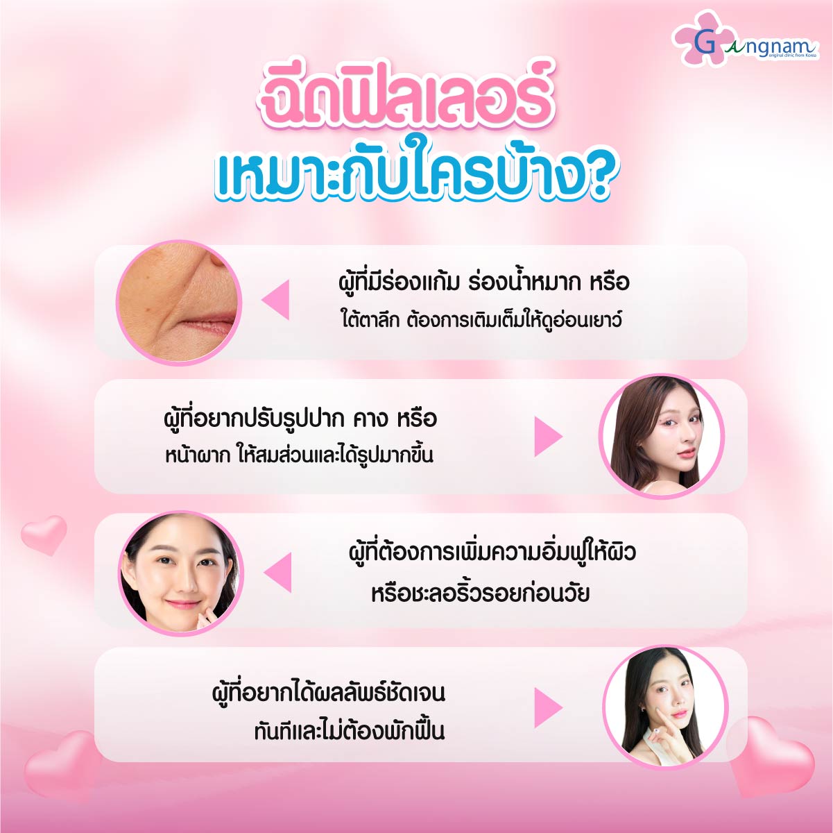 ผู้ที่เหมาะกับการฉีดฟิลเลอร์