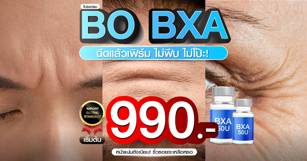 BTXA botox