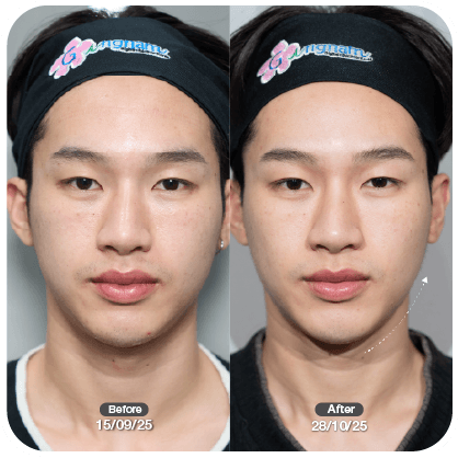 รีวิวผู้ชายเติมโบ