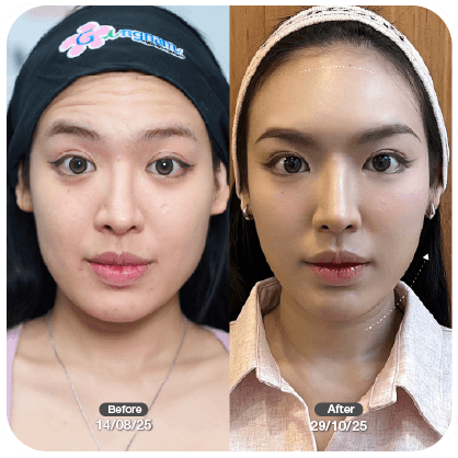 รีวิวผู้หญิงเติมโบ 3