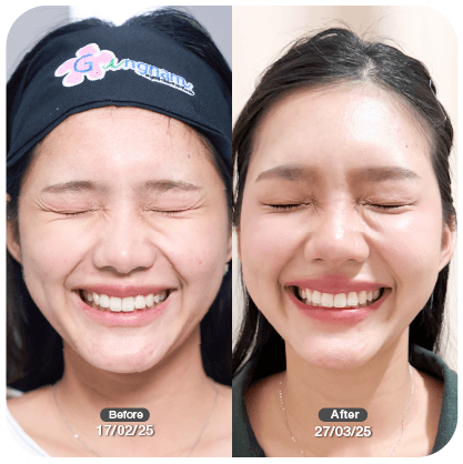 รีวิวผู้หญิงเติมโบ