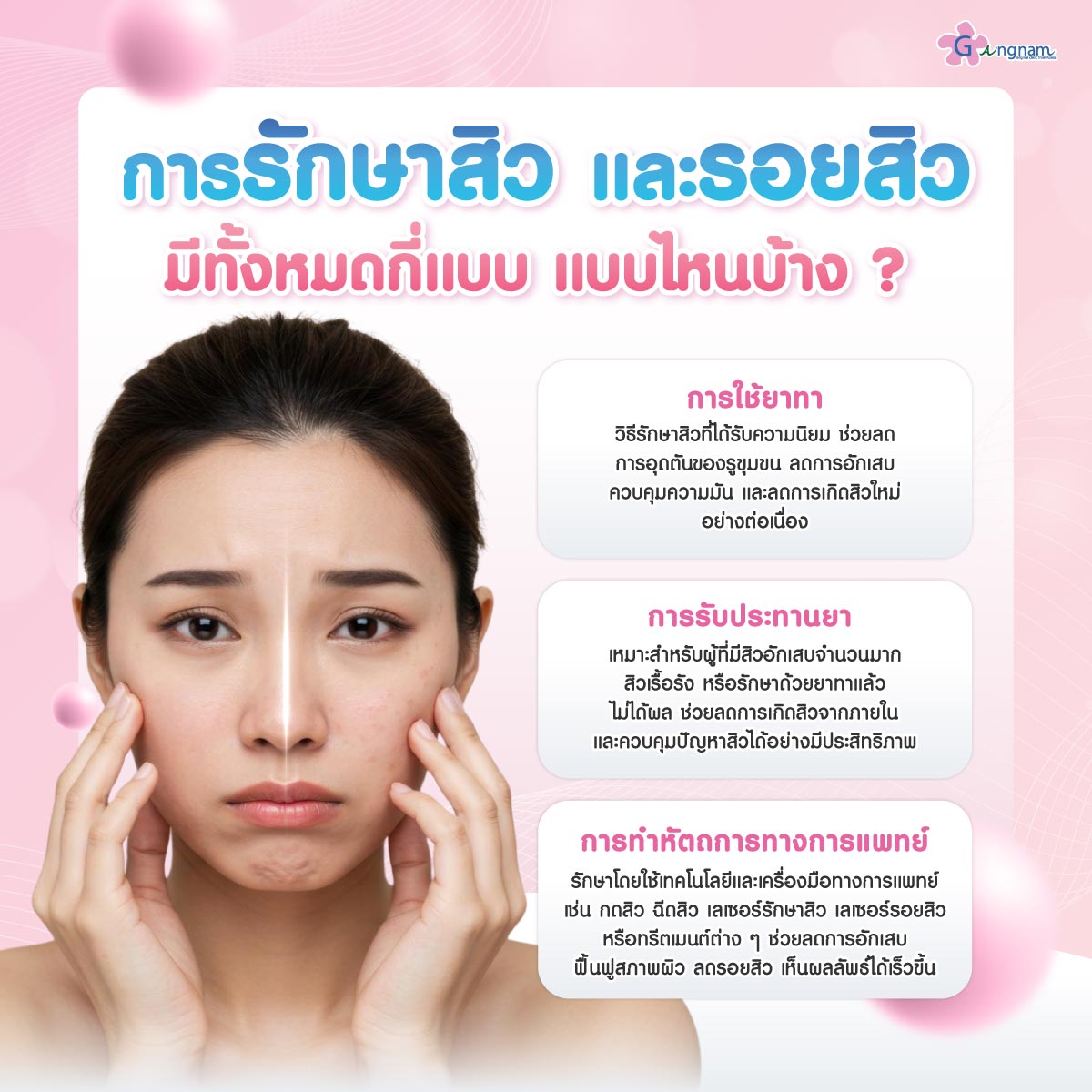 แนวทางการรักษาสิว และรอยสิว