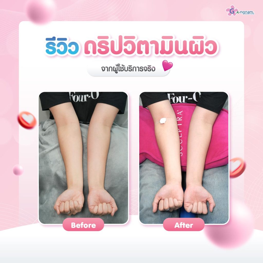 ดริปผิวขาวรีวิว (02)