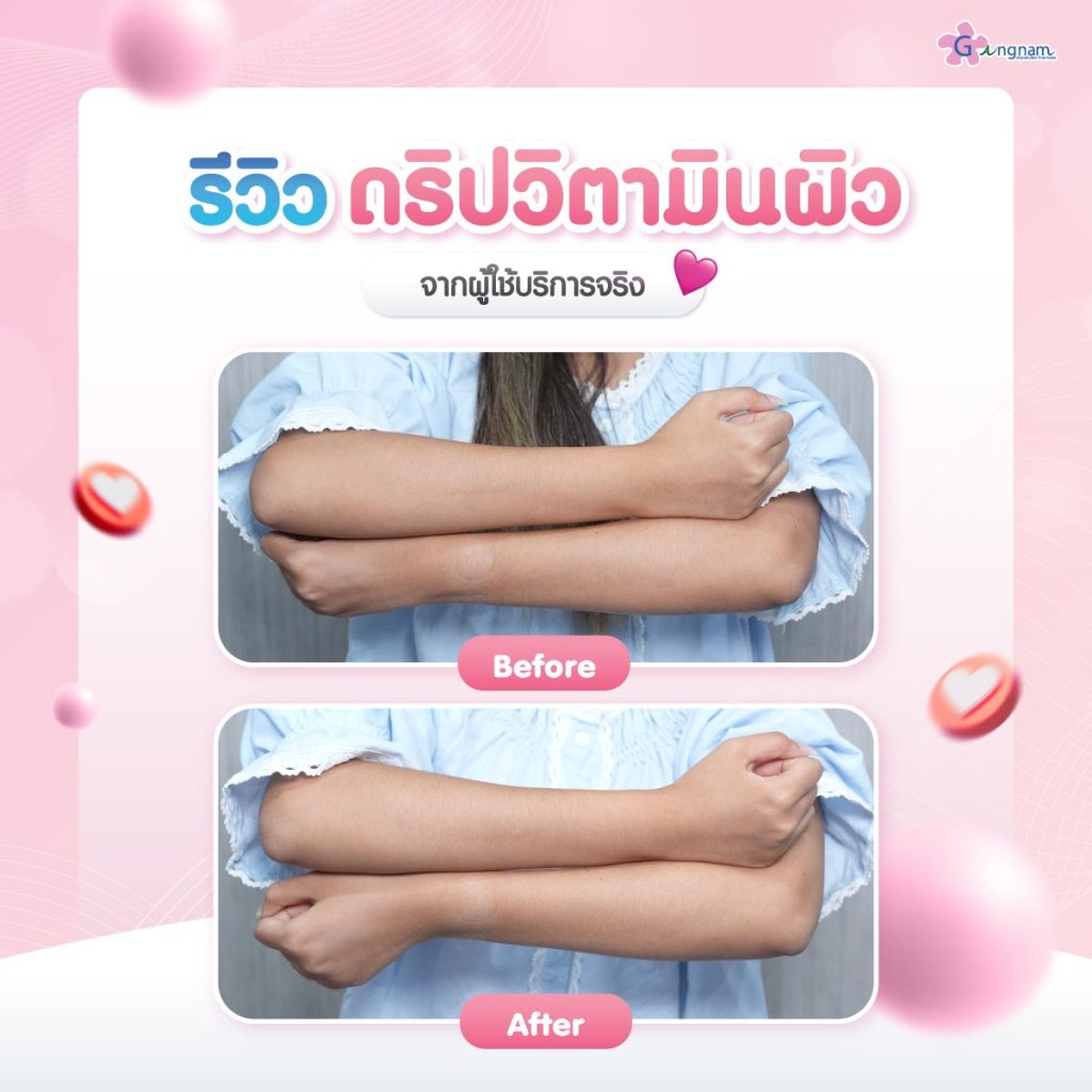 ดริปผิวขาวรีวิว