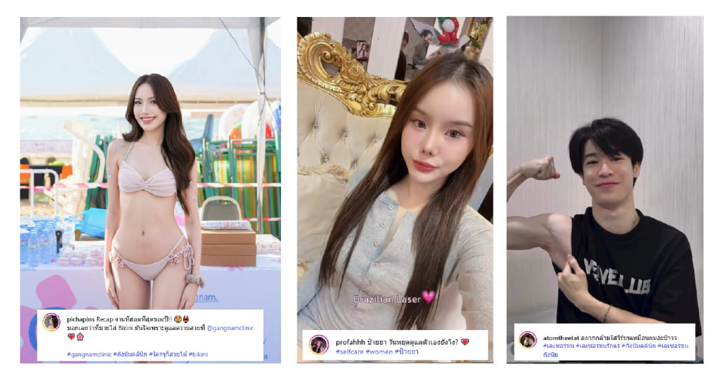 Review ผู้หญิงเลเซอร์ขน 2