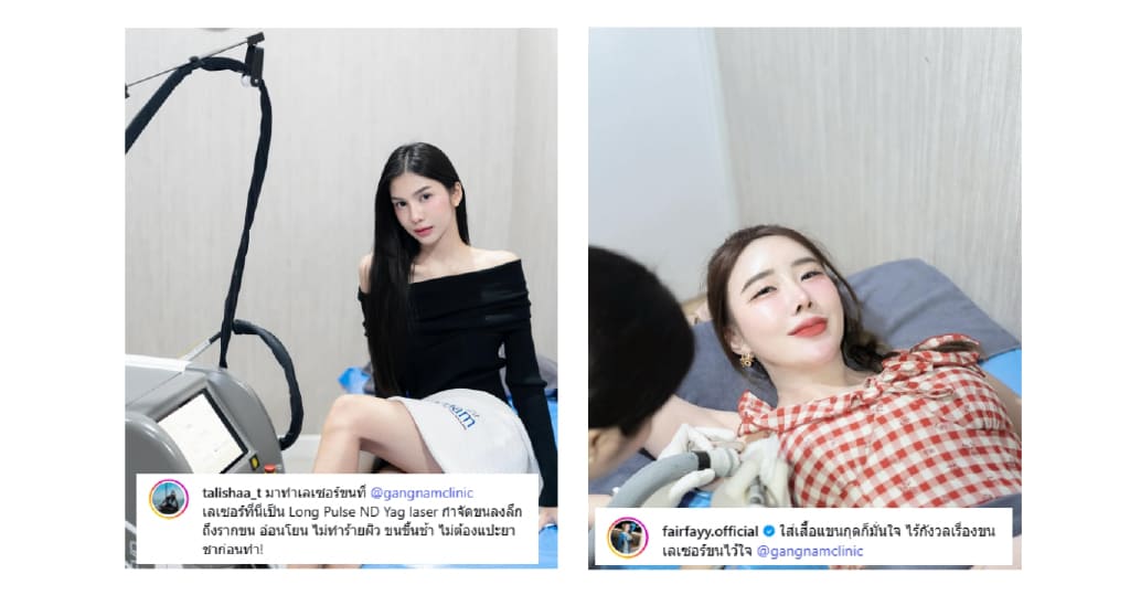 Review เลเซอร์ขน (10)