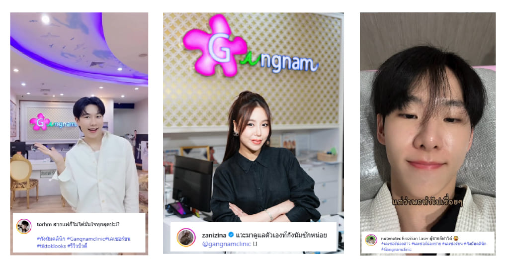 Review เลเซอร์ขน (3)