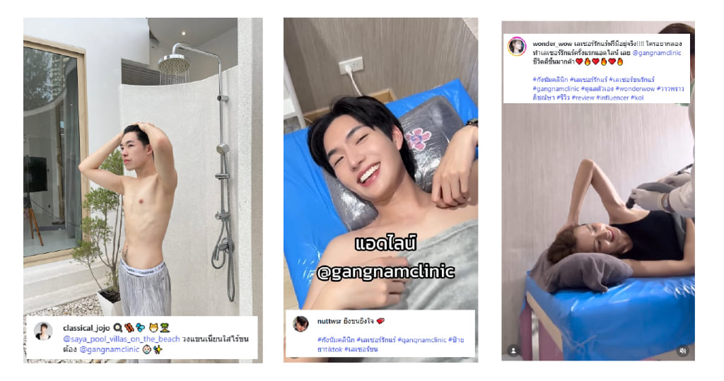 Review เลเซอร์ขน (7)