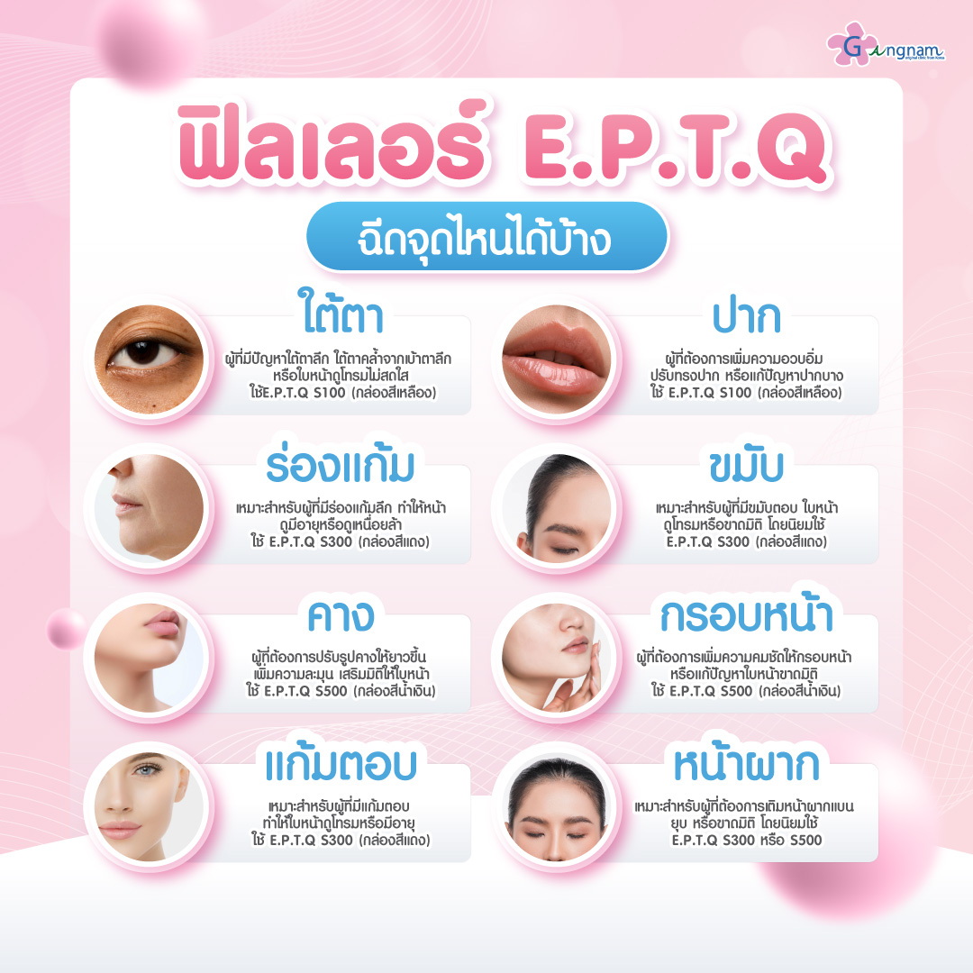 จุดที่เหมาะกับฉีดeptq-ฟิลเลอร์