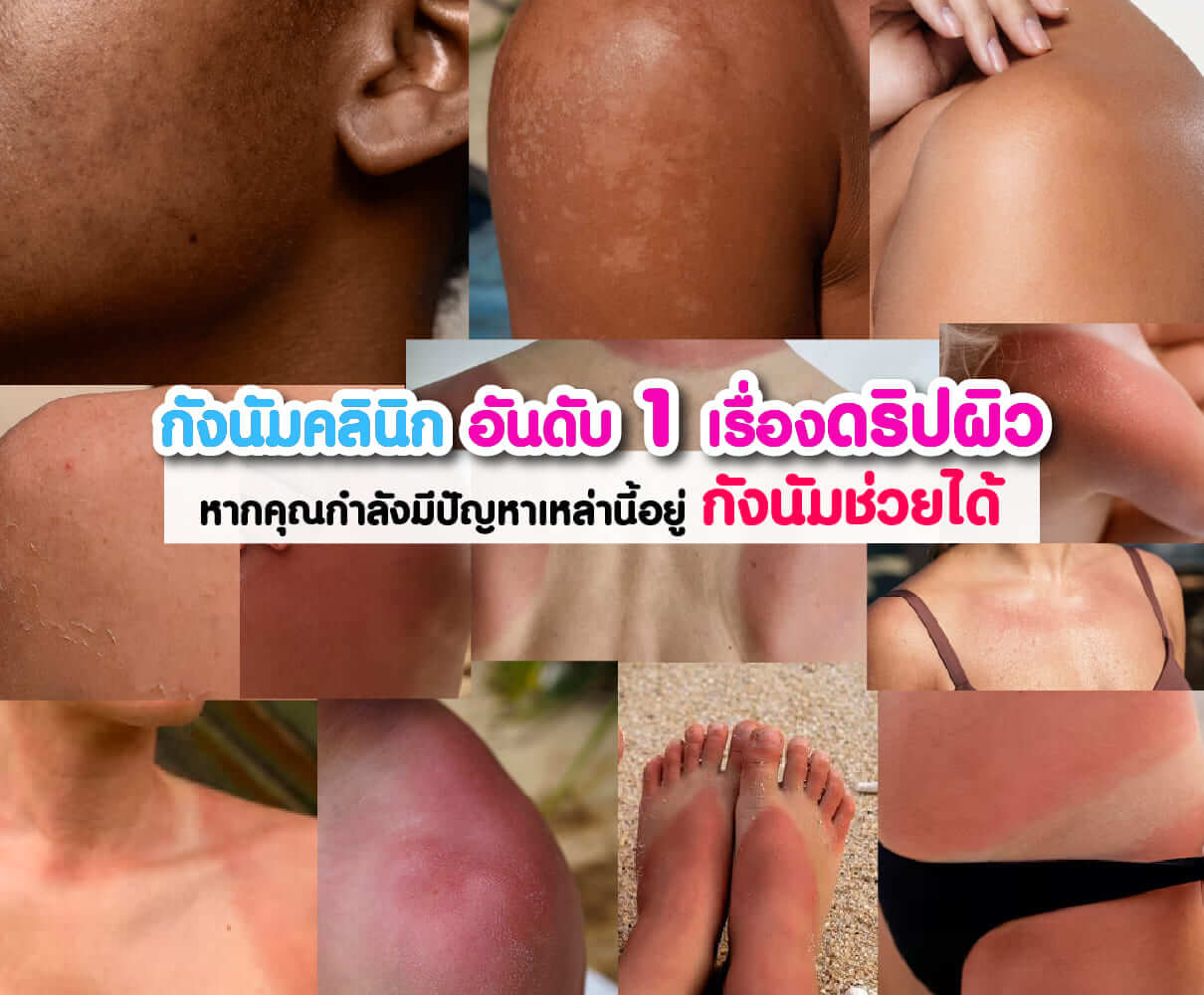 มีปัญหาเรื่องดริปผิว