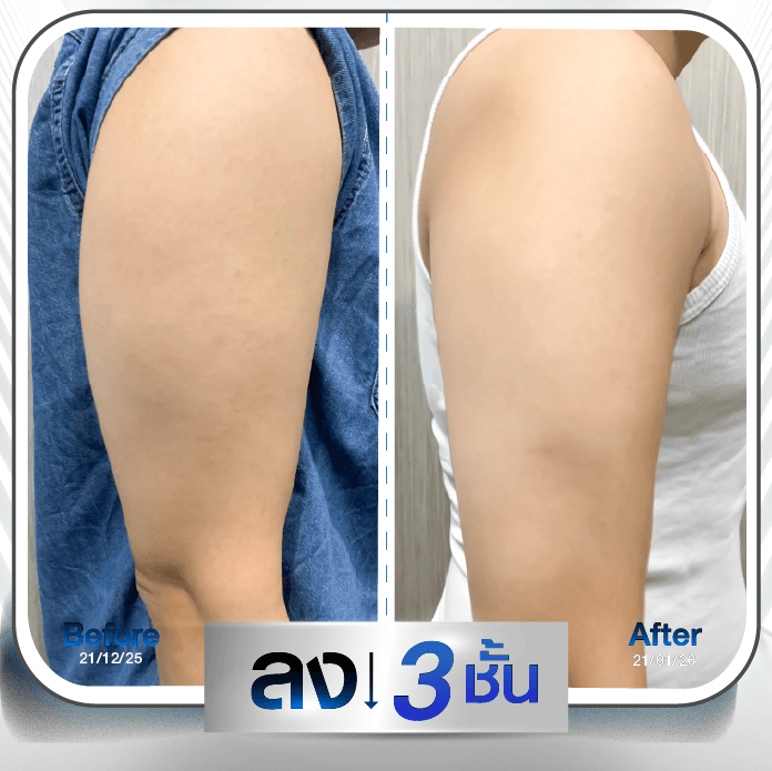 รีวิว ผู้ชายใช้ปากกาลดน้ำหนัก 4