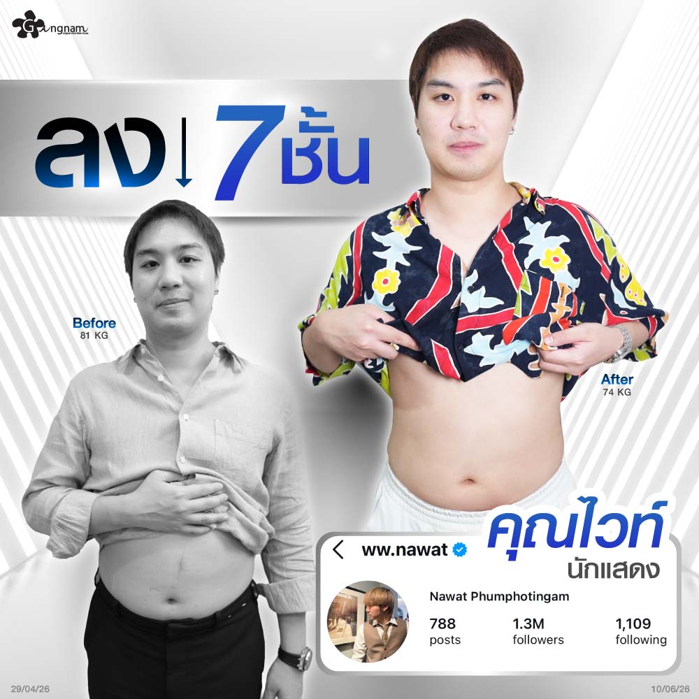 รีวิว ผู้ชายใช้ปากกาลดน้ำหนัก slimera