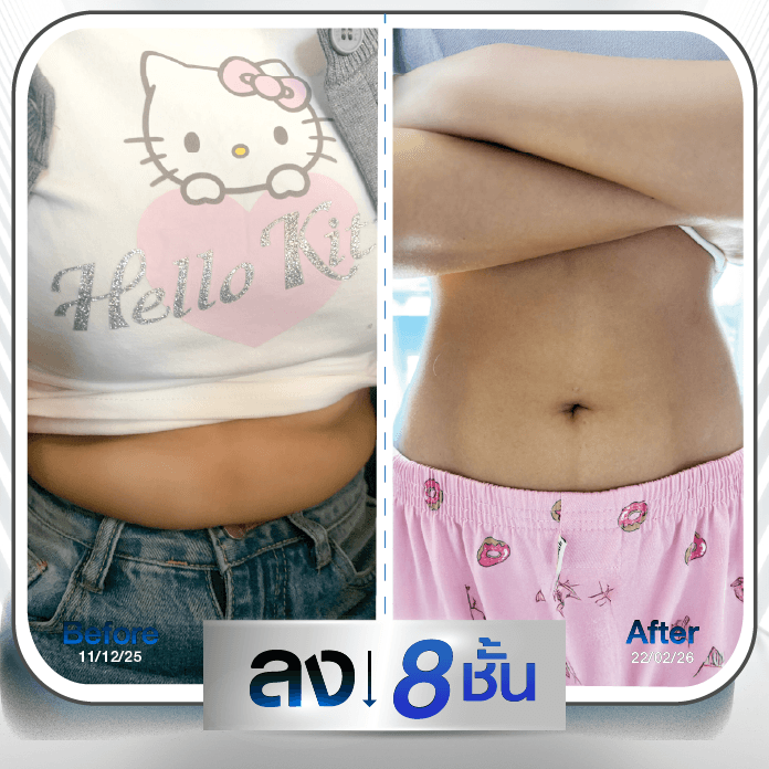 รีวิว ผู้หญิงใช้ปากกาลดน้ำหนัก 3