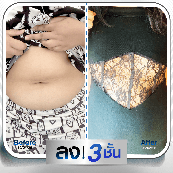 รีวิว ผู้หญิงใช้ปากกาลดน้ำหนัก 5