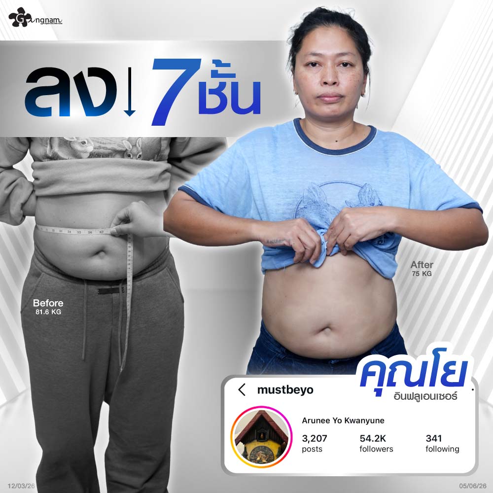 รีวิว ผู้หญิงใช้ปากกาลดน้ำหนัก slimera