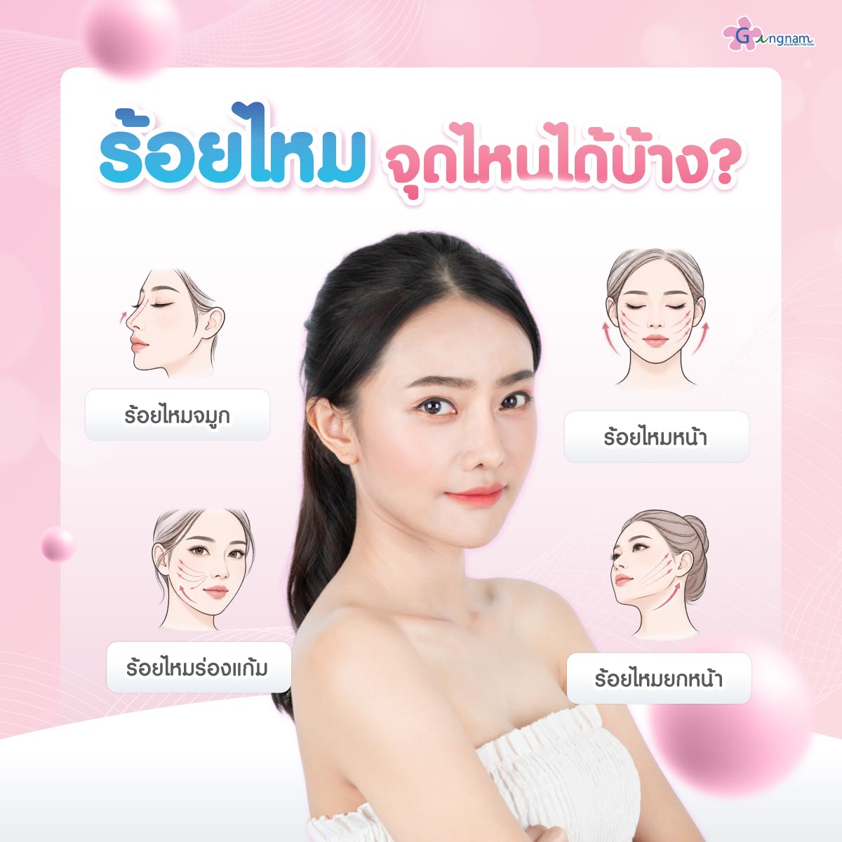 ร้อยไหม จุดไหนได้บ้าง